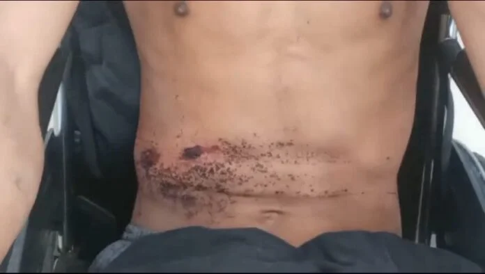 Youth seriously injured after being shot