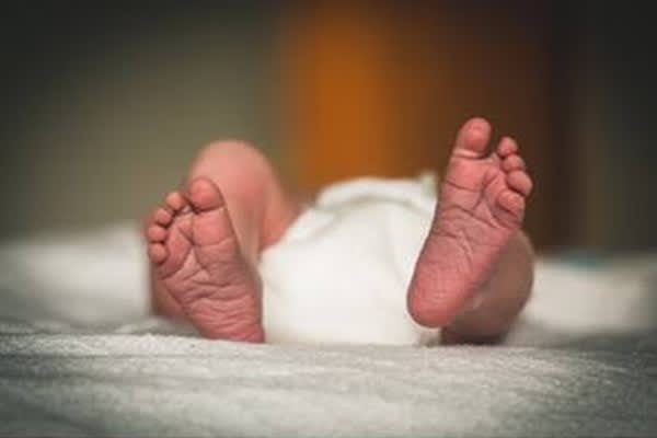 18-day-old baby survives rare intestinal condition after emergency surgery in Tripura