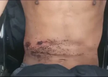 Youth seriously injured after being shot