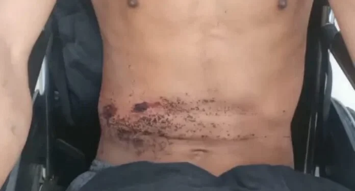 Youth seriously injured after being shot