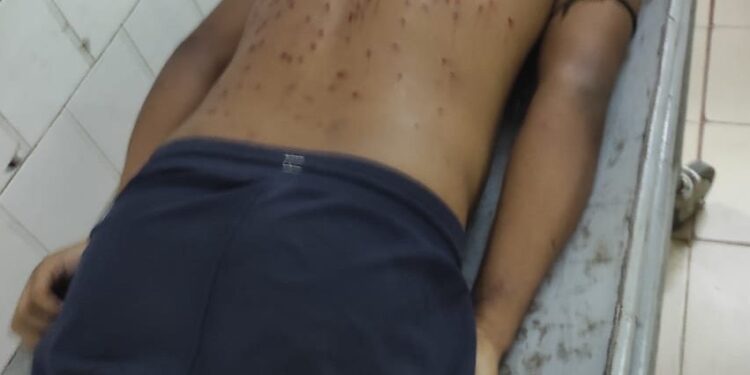 Smuggling Attempt at Boxnagar Border Ends in Gunfire; Youth Injured, Tension Grips Area