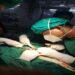 Tripura Doctors Save Newborn with Rare Congenital Defect After Complex Emergency Surgery