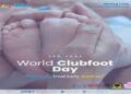 World Clubfoot Day Observed in North Tripura, Focus on Early Treatment