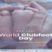 World Clubfoot Day Observed in North Tripura, Focus on Early Treatment